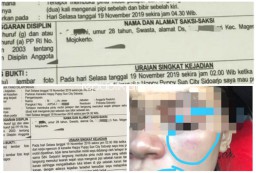 Usai Karaoke, Oknum Polisi Sidoarjo Aniaya Pemandu Lagu Cantik