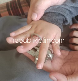Jari Anak Usia 5 Tahun Terjepit Lubang Jendela, Dievakuasi Petugas Damkar Sidoarjo