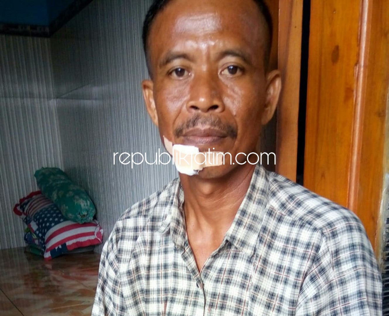 KORBAN - Misari (54) korban penembakan komplotan pencuri menunjukkan luka yang dideritanya dan menceritakan aksi kawanan pencuri berpistol itu, Senin (18/02/2019).