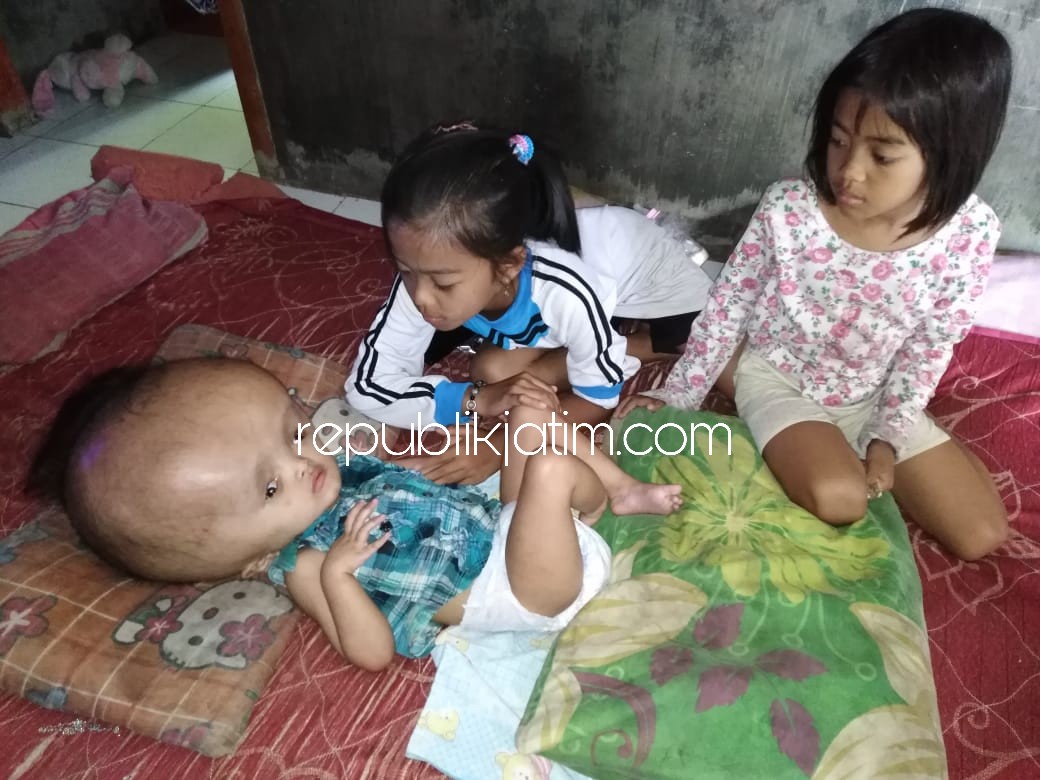RAWAT - Fatimah (3,5) balita penderita Hydrocephalus yang terbaring lemas dijaga dua kakak kandungnya, Mirathul Aufa (11) dan Rini Nur Cahyati (7) saat ditinggal ayahnya berjualan sayuran, Senin (03/09/2018).