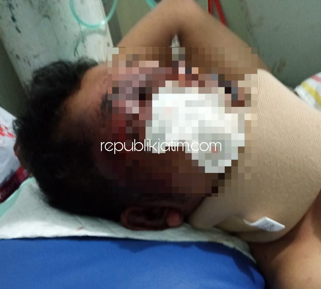 DIRAWAT - Korban pembegalan, Adin Hariyanto (26) warga Desa Jumlutrejo, Kecamatan Sukodono, Sidoarjo saat dirawat di rumah sakit dalam kondisi luka berat, Jumat (02/10/2020).