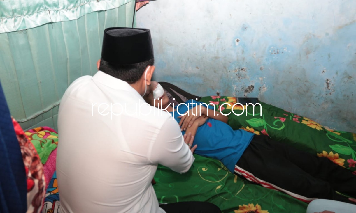 TUMOR - Derita Fungki Suderajat (28) warga Desa Barengkrajan, Kecamatan Krian, Sidoarjo yang mengidap tumor di mata mendapat perhatian Pemkab Sidoarjo dengan ditangani Wabup Sidoarjo, Subandi di kosannya, Rabu (03/11/2021).