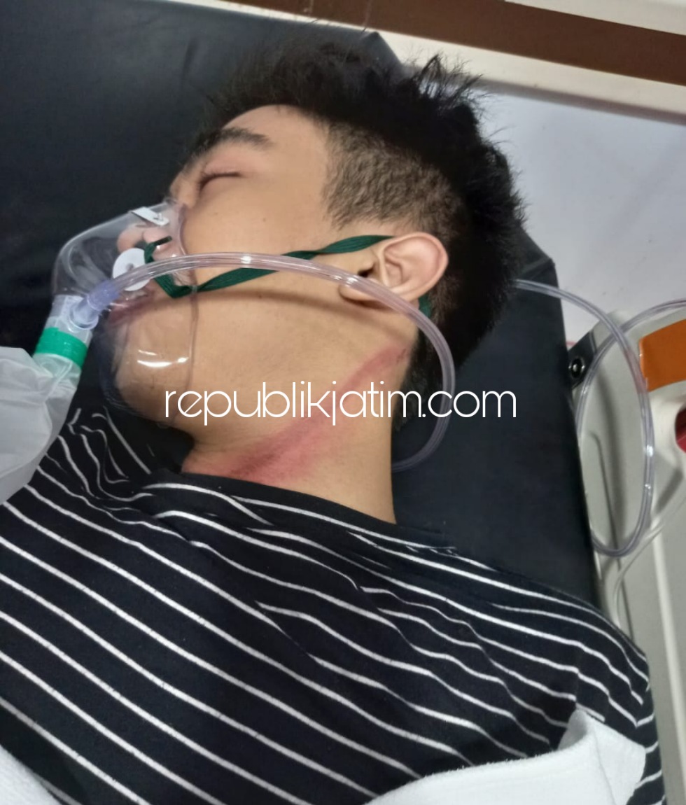 DIRAWAT - Korban Muhammad Akbar Al Farizi (20) warga JL Tri Tunggal, Desa Pepe, Kecamatan Sedati, Sidoarjo dirawat di RSUD Sidoarjo, Selasa (26/04/2022).