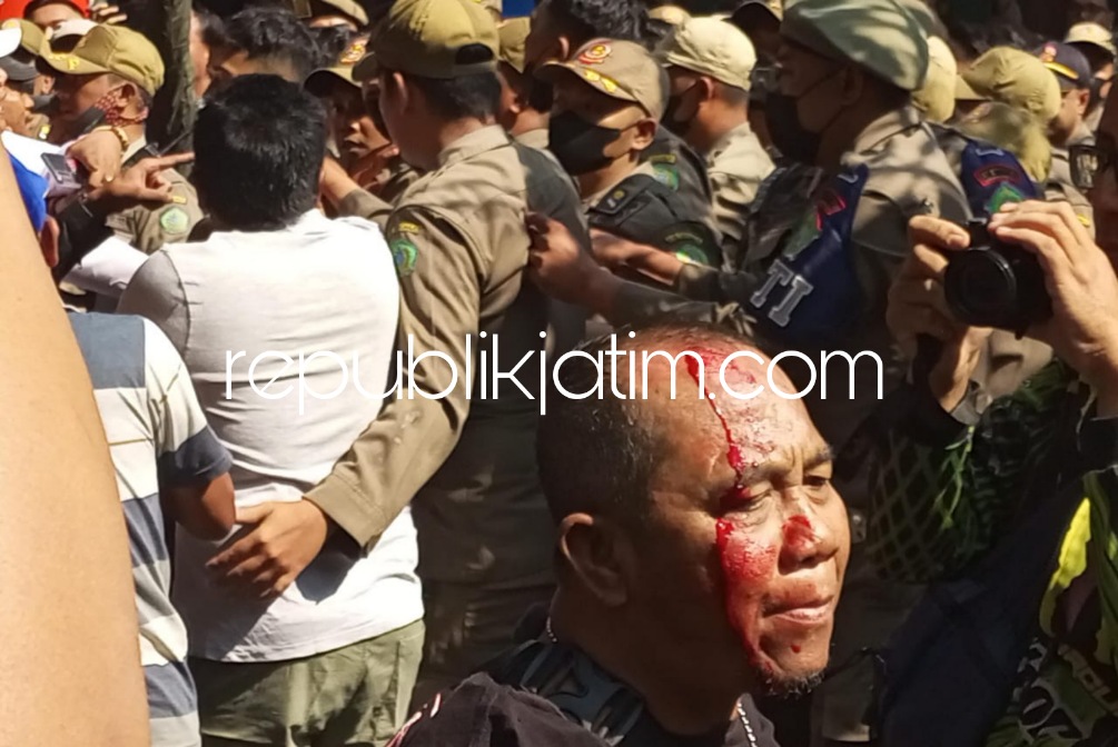 TERLUKA - Salah seorang Pedagang Kaki Lima (PKL) Pasar Larangan, Kecamatan Candi, Sidoarjo terluka saat penertiban pedagang di lapak depan Pasar Larangan, Senin (31/07/2023).