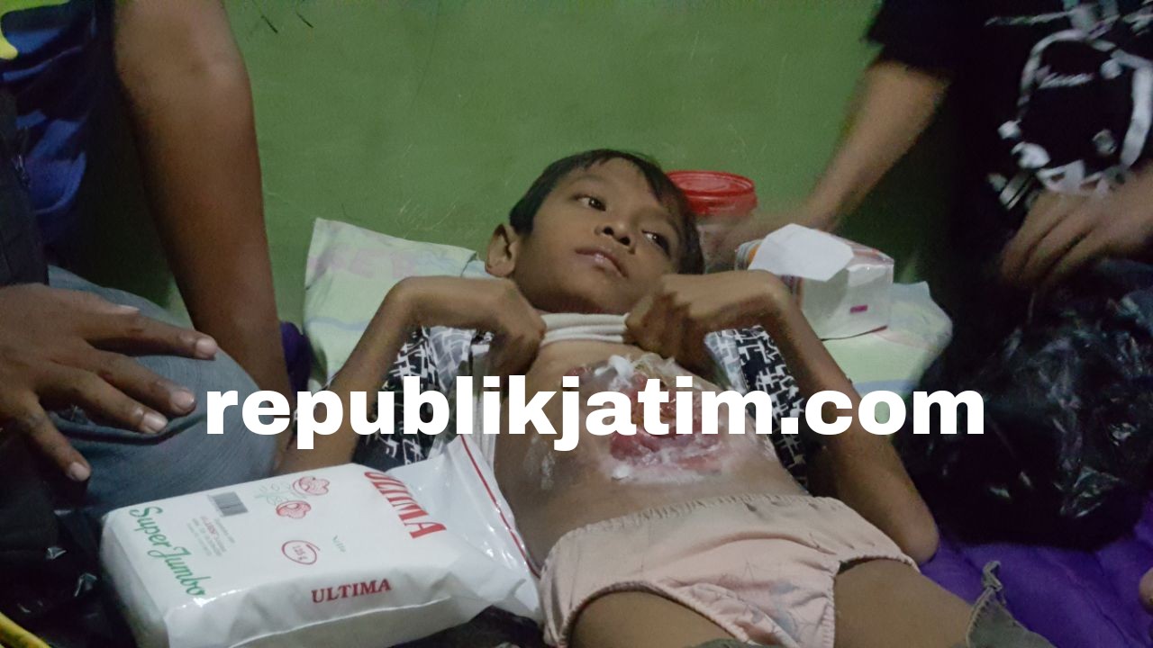 MENDERITA OFALOKEL - Dava Andhika Putra (12) putra pertama pasutri, Andi dan Mike Hermawati yang tinggal di kos JL Swadaya, Desa Masangan Wetan, Kecamatan Sukodono menderita ofalokel (usus keluar) sejak 11 tahun tidak mendapatkan perawatan tim medis.